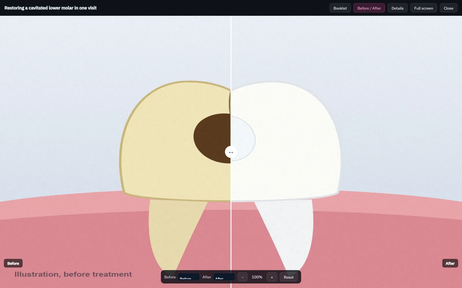 Before-and-after case study viewer